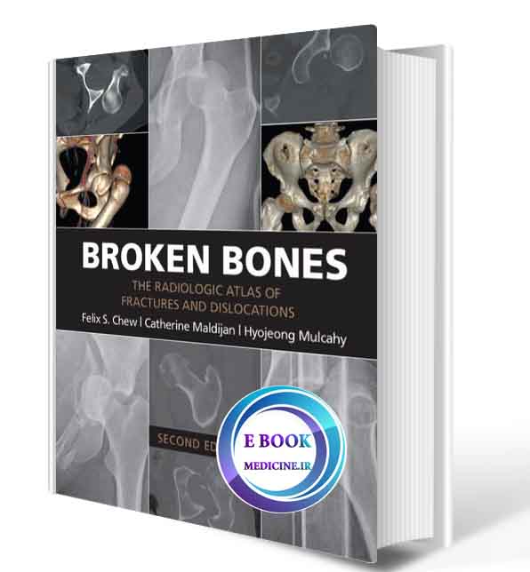 دانلود کتابBroken Bones: The Radiologic Atlas of Fractures and Dislocations 2nd( PDF)